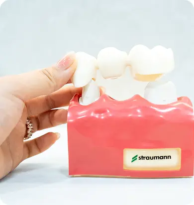 Crown & Bridge in Liberty Dental