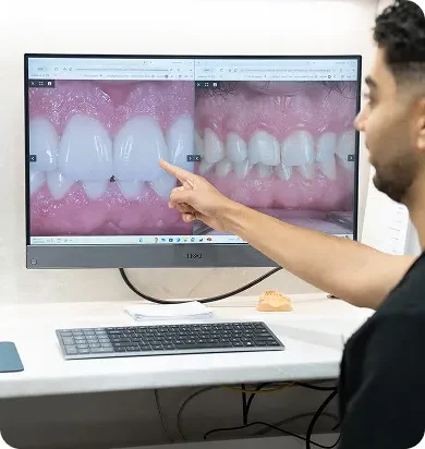 Gummy Contouring in Liberty Dental