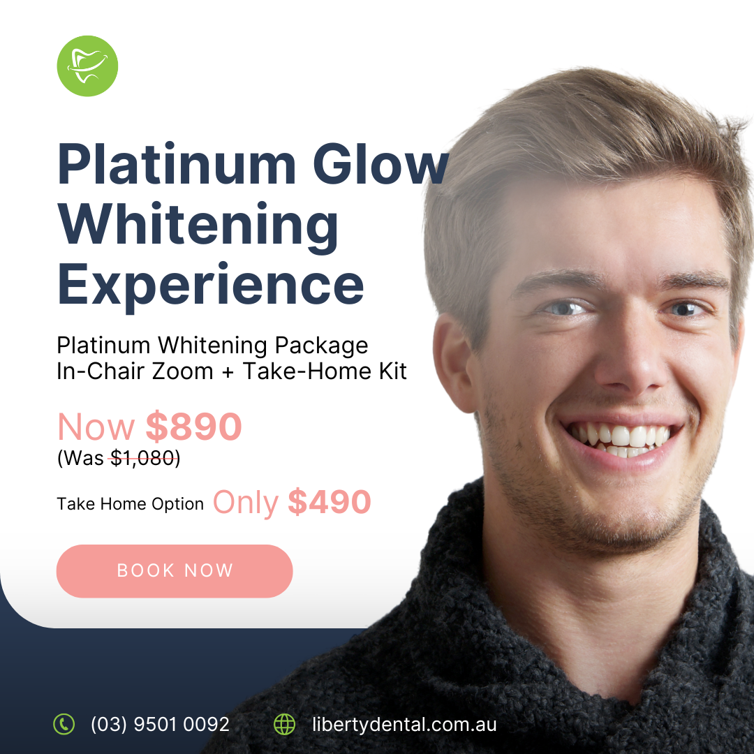 Platinum Glow Whitening Experience – Reveal Your Radiance In Liberty Dental
