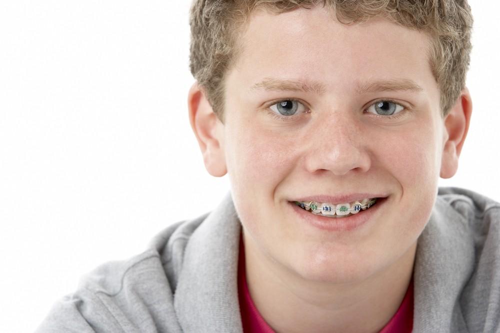 Why Should You Consider Braces for Your Teenager in Wheelers Hill?