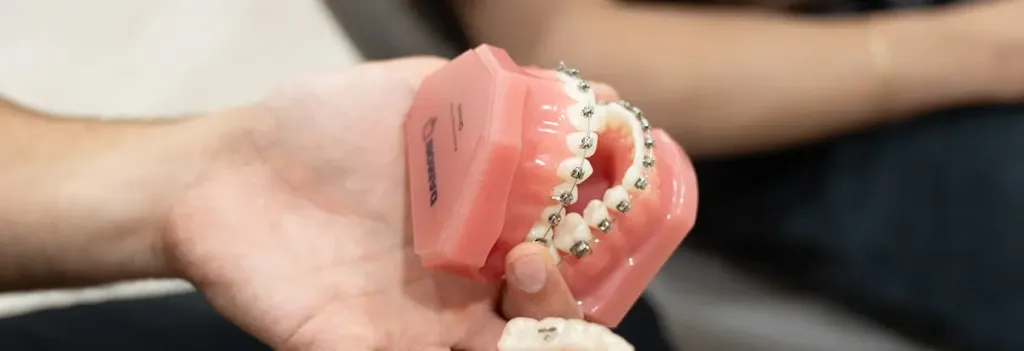 Braces In Liberty Dental Centre Melbourne Wheelers Hill & Mount Waverley