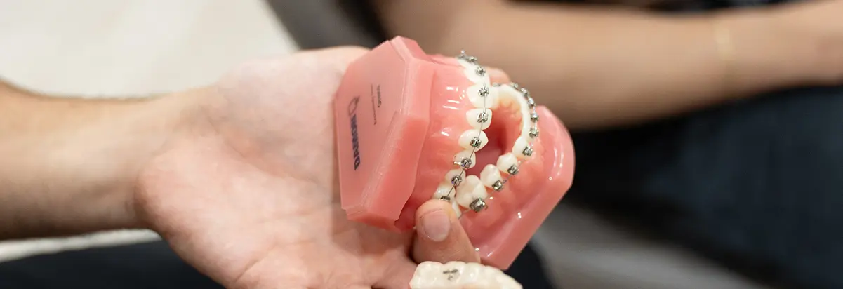 Braces In Liberty Dental Centre Melbourne Wheelers Hill & Mount Waverley