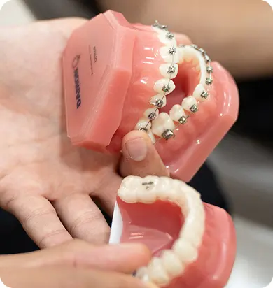 Braces in Liberty Dental