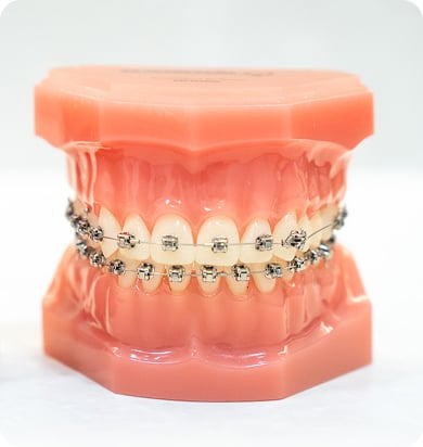 Early Orthodontics in Liberty Dental