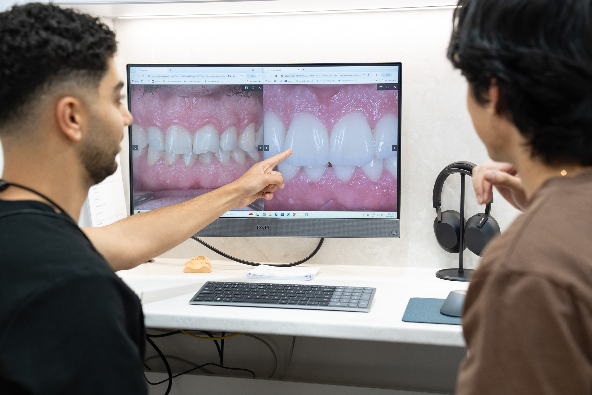 Teeth Whitening Cost Near Mount Waverley (And What You’re Actually Paying For)